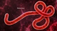 The Ebola outbreak in Congo has become the country’s deadliest.