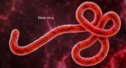 The Ebola outbreak in Congo has become the country’s deadliest.