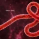 The Ebola outbreak in Congo has become the country’s deadliest.
